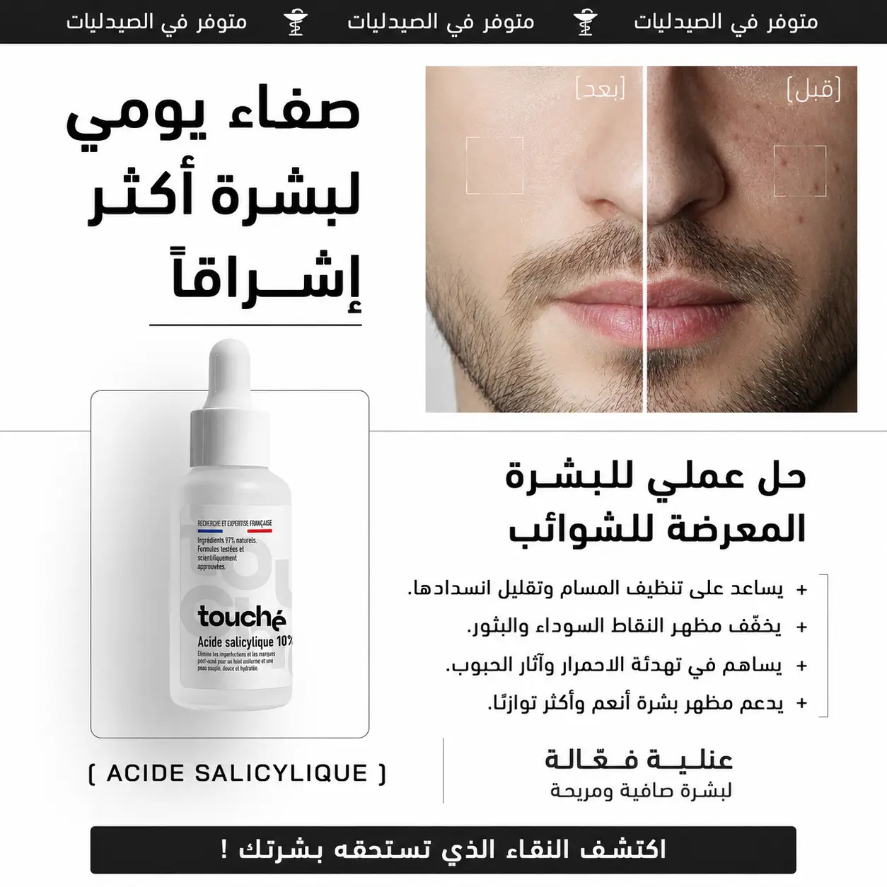 سيروم حمض الساليسيليك المعجزة: وداعًا للحبوب والرؤوس السوداء ومرحبًا ببشرة صافية ومتوازنة