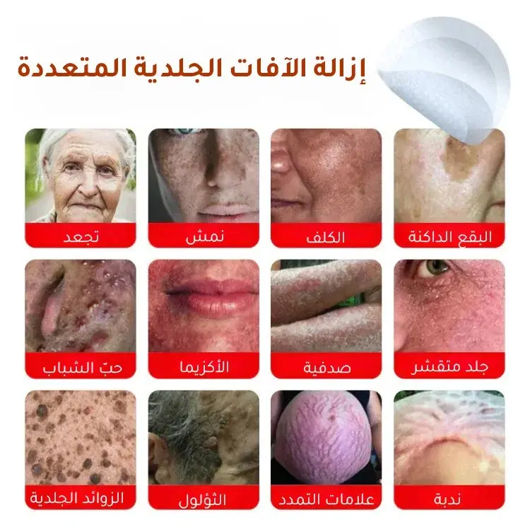 لصقات طبية فعّالة لإزالة الثآليل من الجسم بدون ألم
