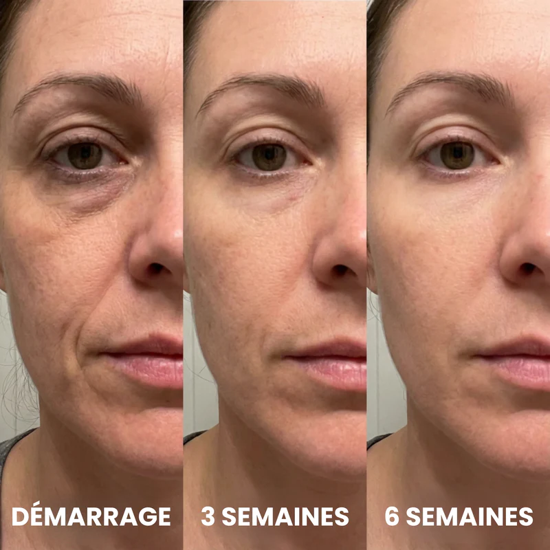 Crème au collagène anti-rides anti-cernes anti-poches pour le contour des yeux